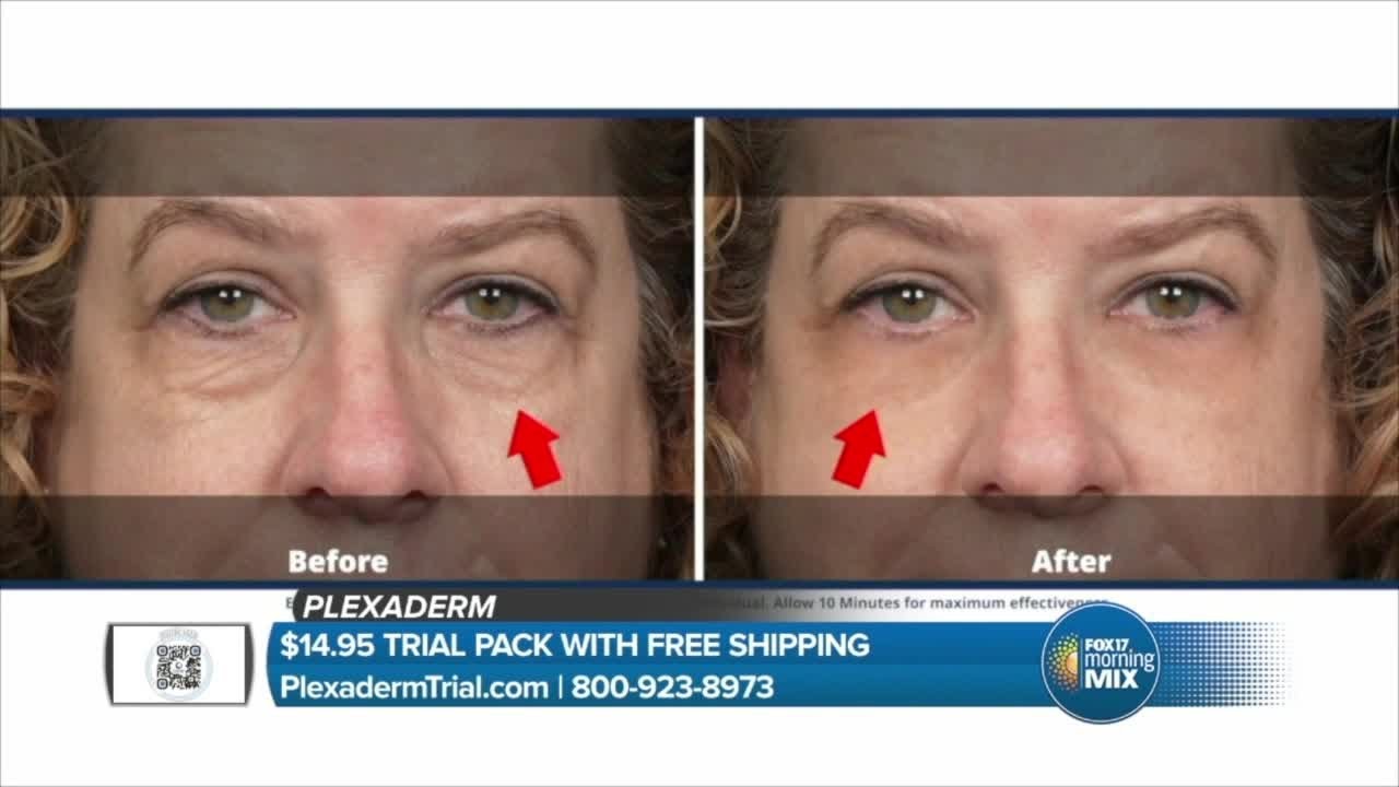 Plexaderm reduces the appearance of wrinkles and fine lines (sponsored)