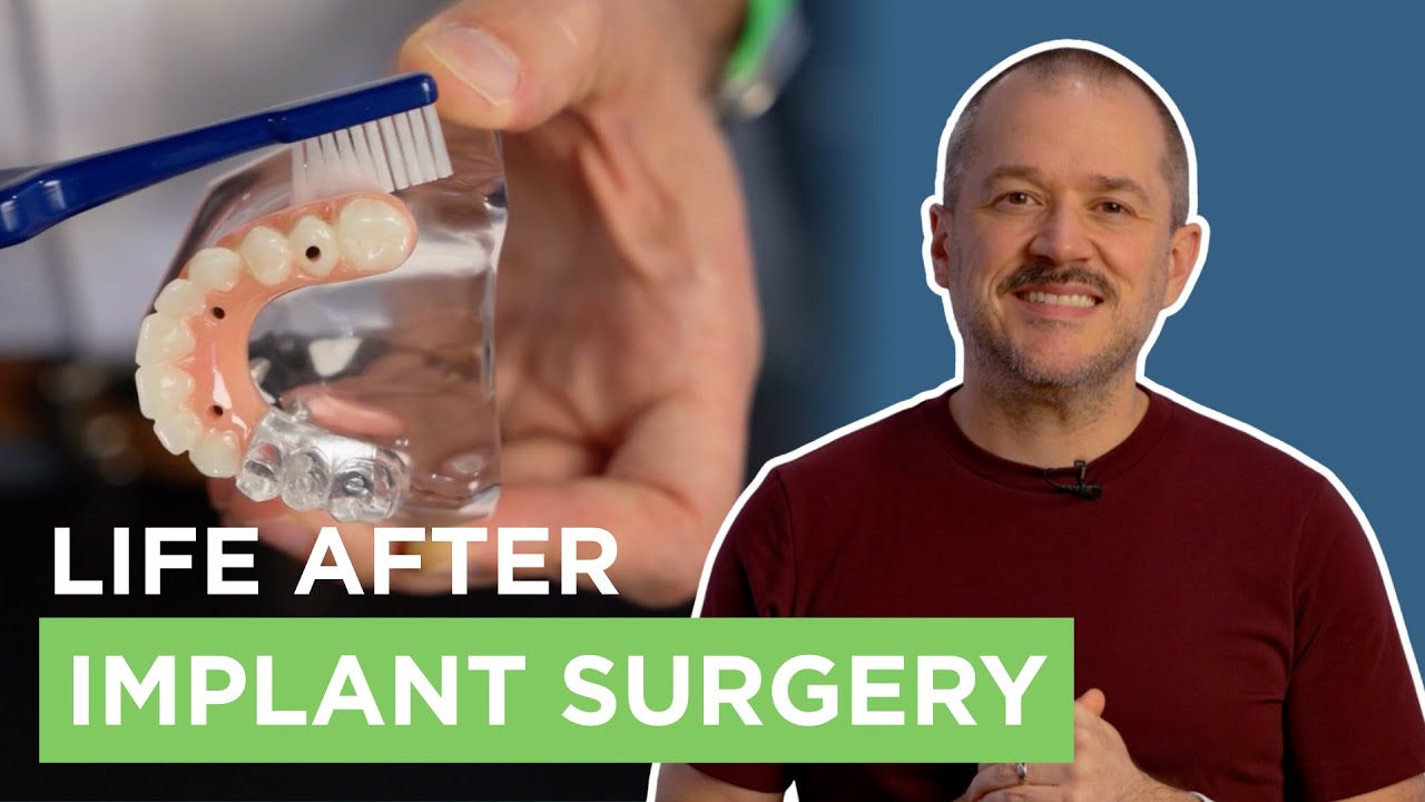 What To Actually Expect After Dental Implant Surgery | Recovery Tips