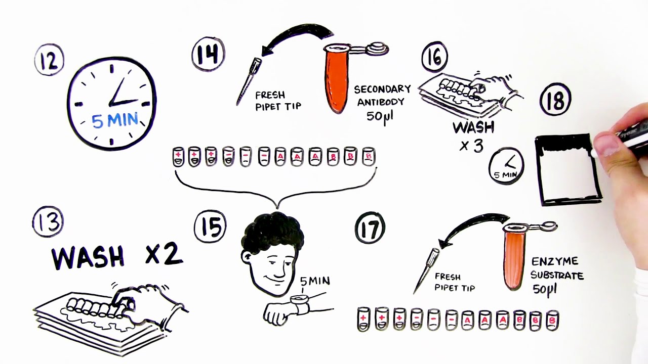 ELISA Immuno Explorer Kit Student Activity Video Quick Guide