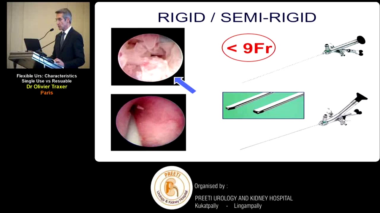 Flexible ureteroscope charateristics single use vs reuseable by Dr Oliver Traxer (paris)