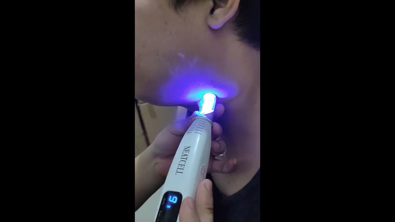 CARA PAKAI NEATCELL PICOSECOND LASER PORTABLE