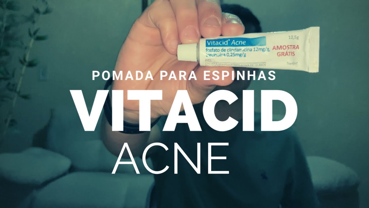 VITACID ACNE - A MELHOR POMADA PARA ESPINHAS DO MERCADO