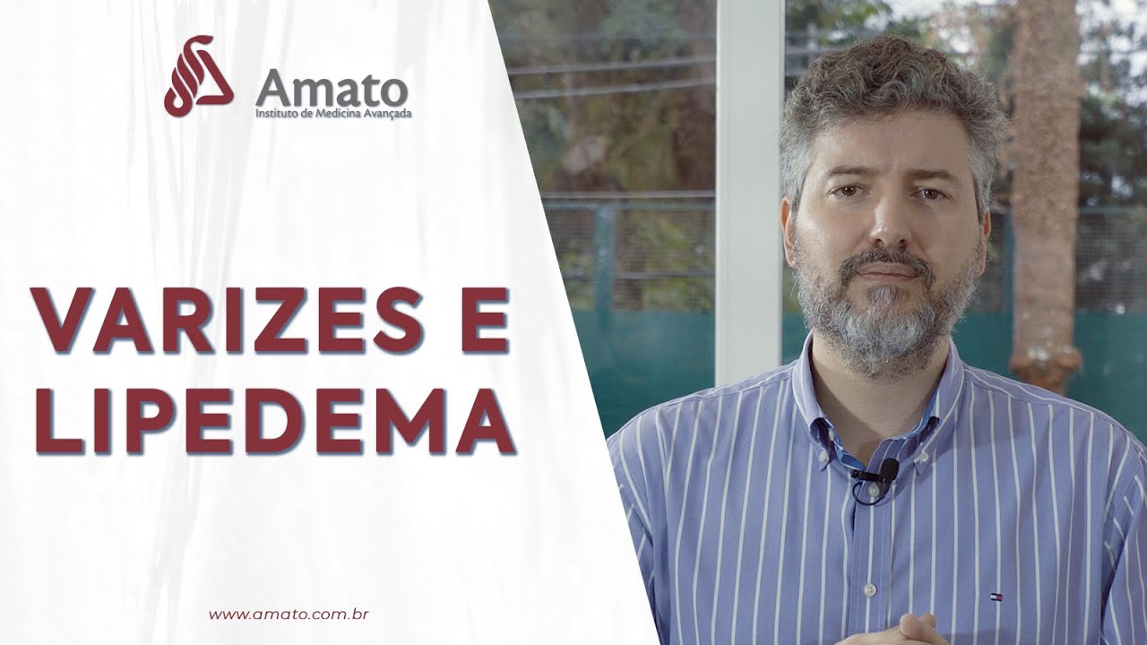 Varizes e Lipedema: má circulação venosa no lipedema
