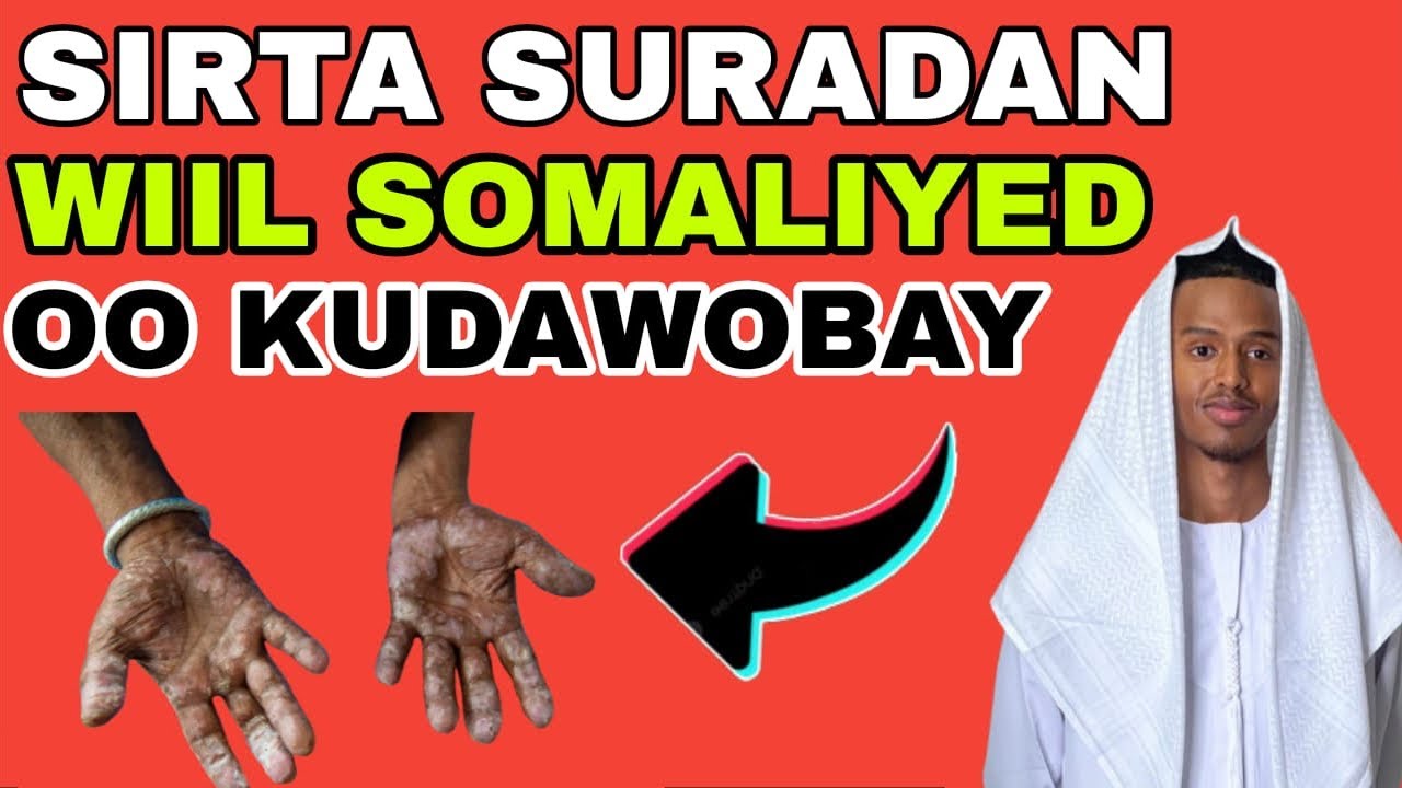 Qiso wiil somaliyed oo mudo dheer xanunsanaa surad uu kudawobay inta jeer uu akhriyay inte jeer