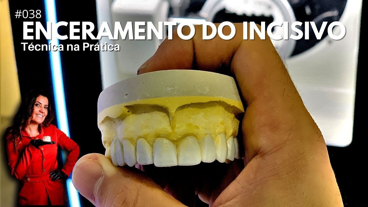 Enceramento Diagnóstico: Incisivo  Central(11) - Técnica Na Prática (#038)