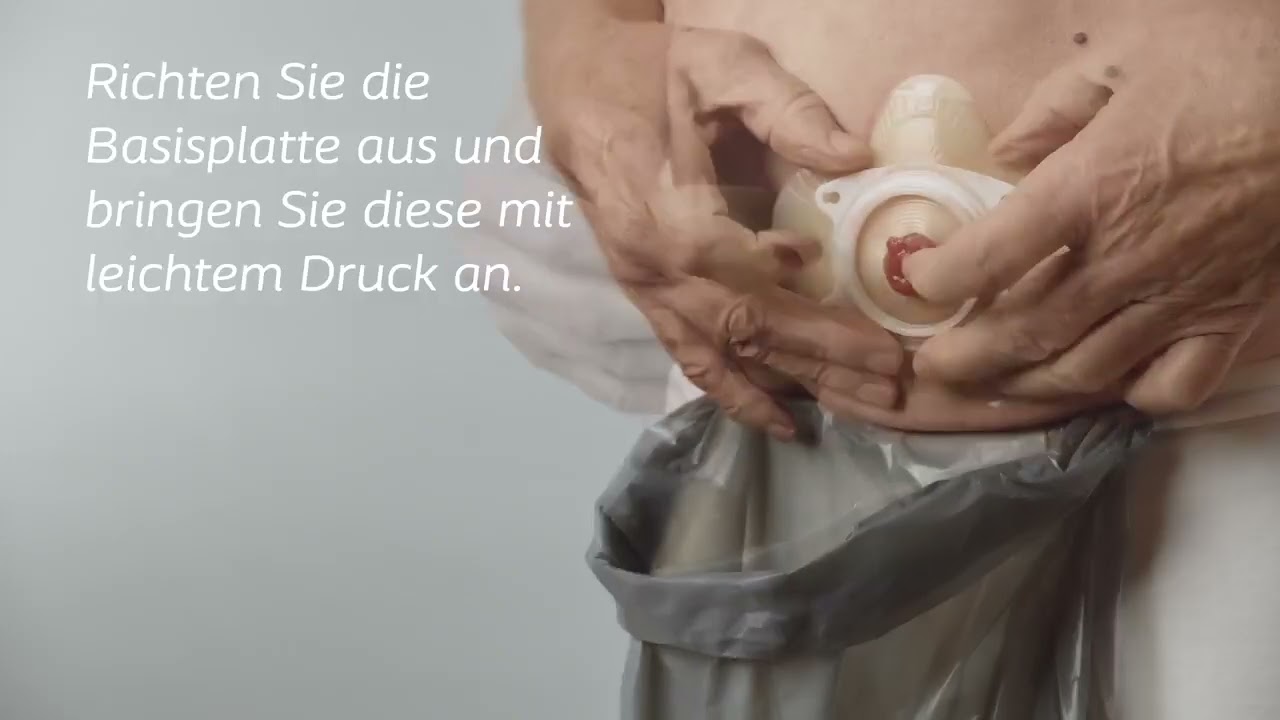SenSura® Mio Konkav Click Zweiteilige Versorgung (Geschlossen) - Anleitungsvideo