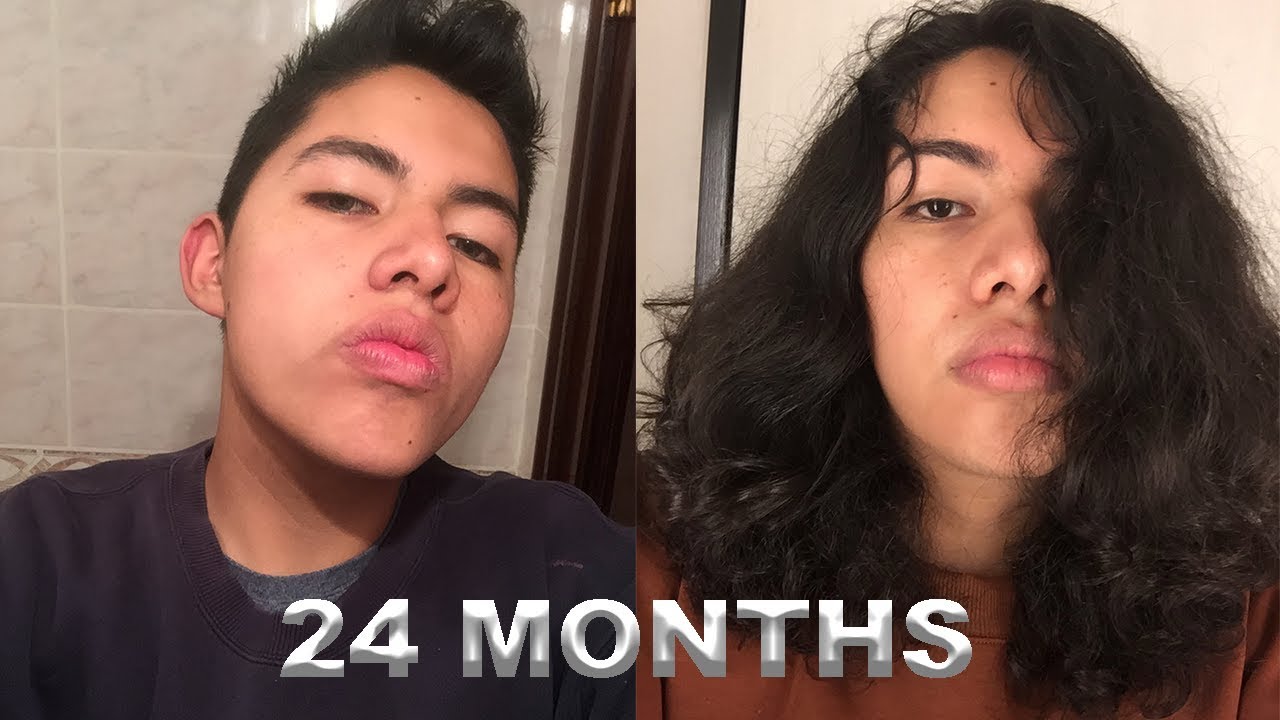 Men's 2 Years Hair Growth Time Lapse