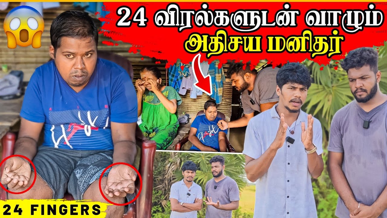 24 விரல்களுடன் வாழும் அதிசய மனிதப் பிறவி | வாழும் வயதில் வந்த வினை | Rj Tamizha