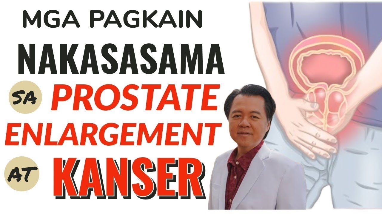 Mga Pagkain Puwede Makasama sa Prostate Enlargement at Kan-ser - By Doc Willie Ong