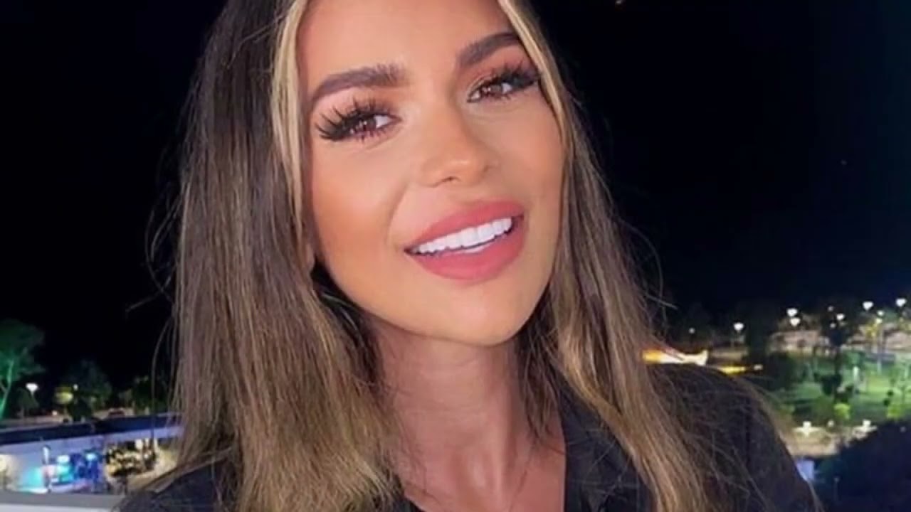 Love Island 2022 stars before and after surgery including huge makeover for Ekin-Su