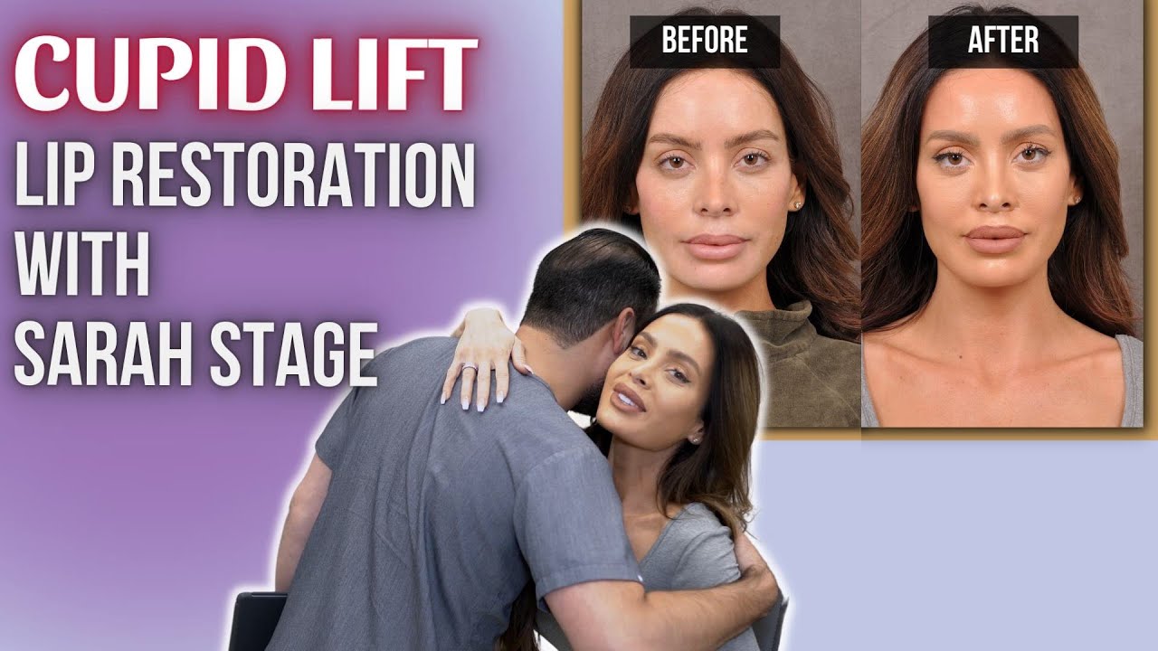 CUPID LIFT™: Lip Restoration with Sarah Stage