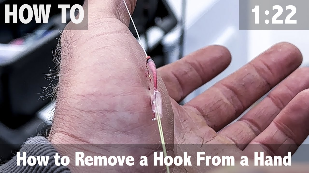 How to Remove a Hook from a Hand