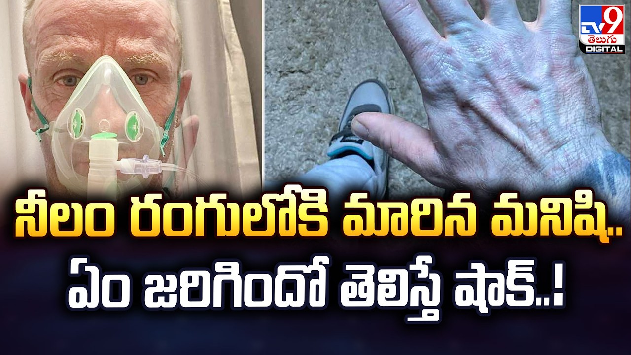 నీలం రంగులోకి మారిన మనిషి.. ఏం జరిగిందో తెలిస్తే షాక్‌..! - TV9