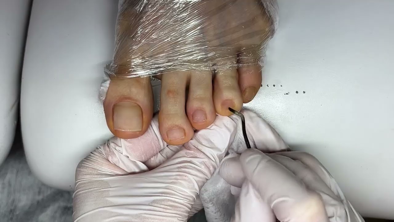 Педикюр, обработка пальчиков ног #педикюр #ногти2025 #мастеркласс #nailart #pedicure #tutorial 