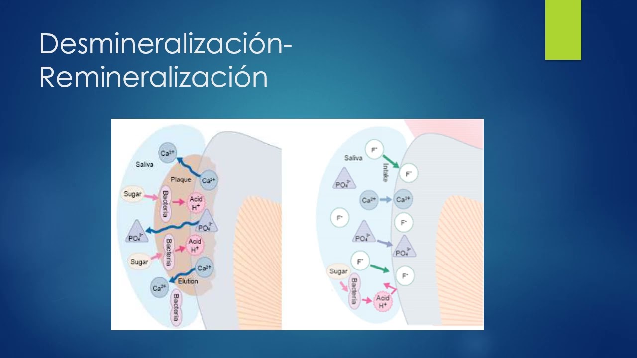 Cariologia Operatoria Dental Universidad de Carabobo 2025
