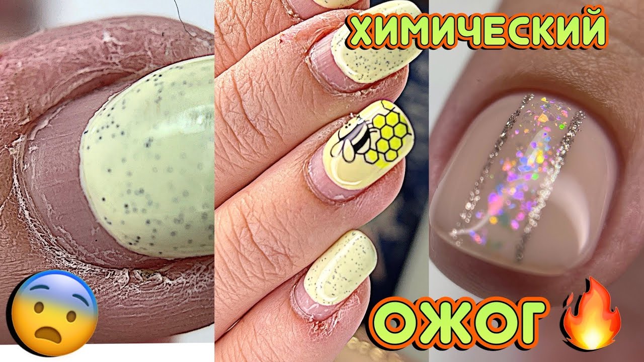 Химический ожог кожи / Мой плохой маникюр / Быстрый дизайн ногтей