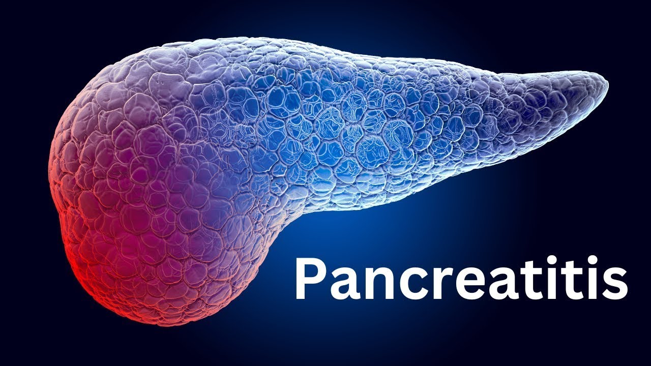 Pancreatitis: Everything You Need To Know