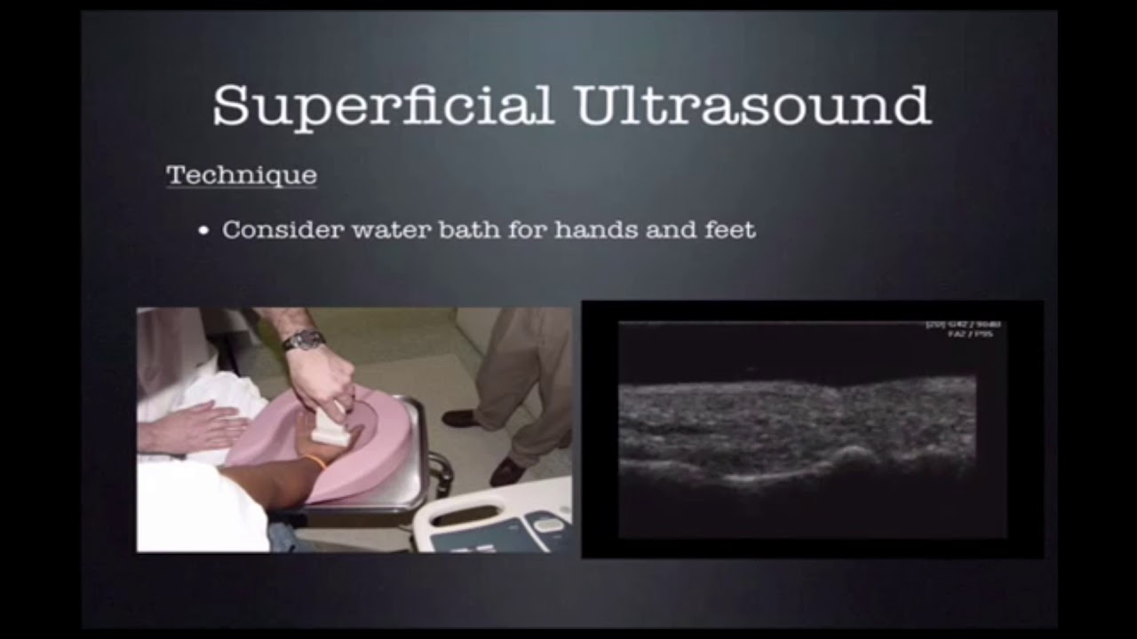 Superficial and Soft Tissue US CUSE 2018