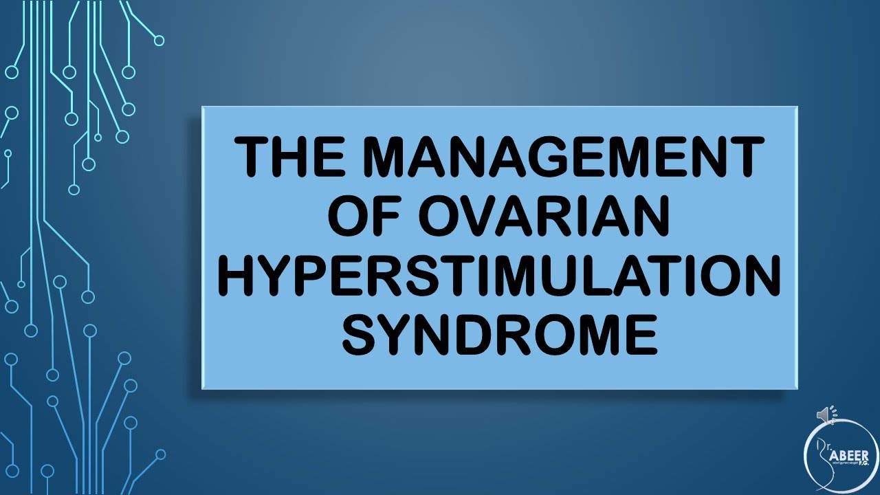 RCOG GUIDELINE The Management of Ovarian Hyperstimulation Syndrome