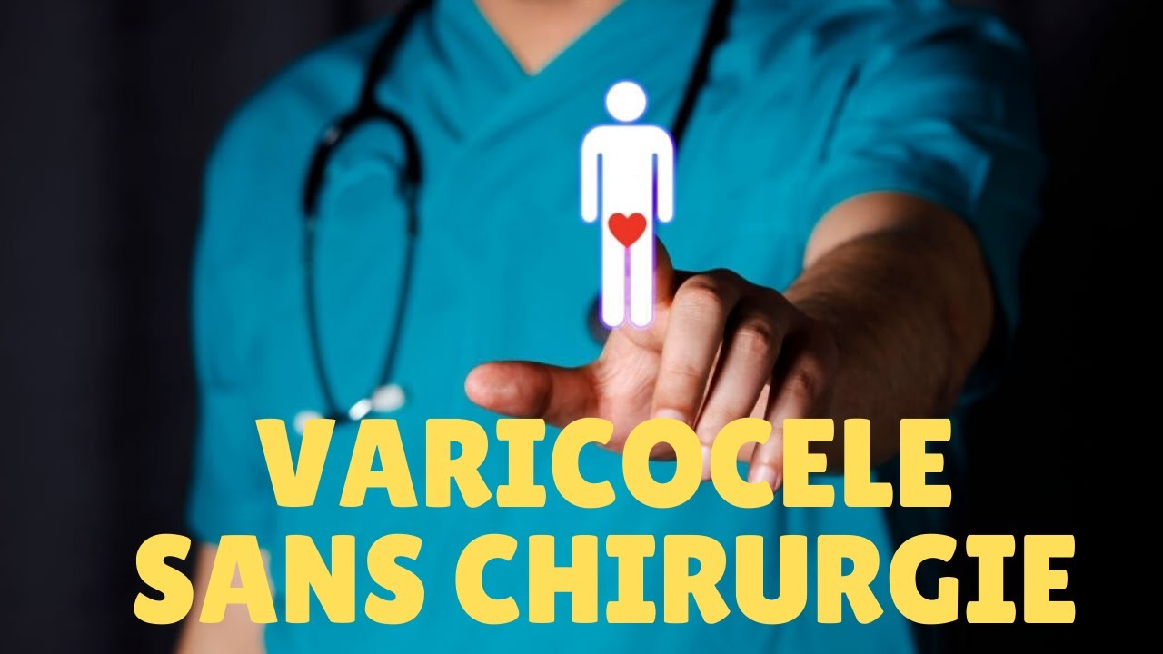 Traitement de Varicocèle (varices) de Testicules sans chirurgie, avec l'Embolisation