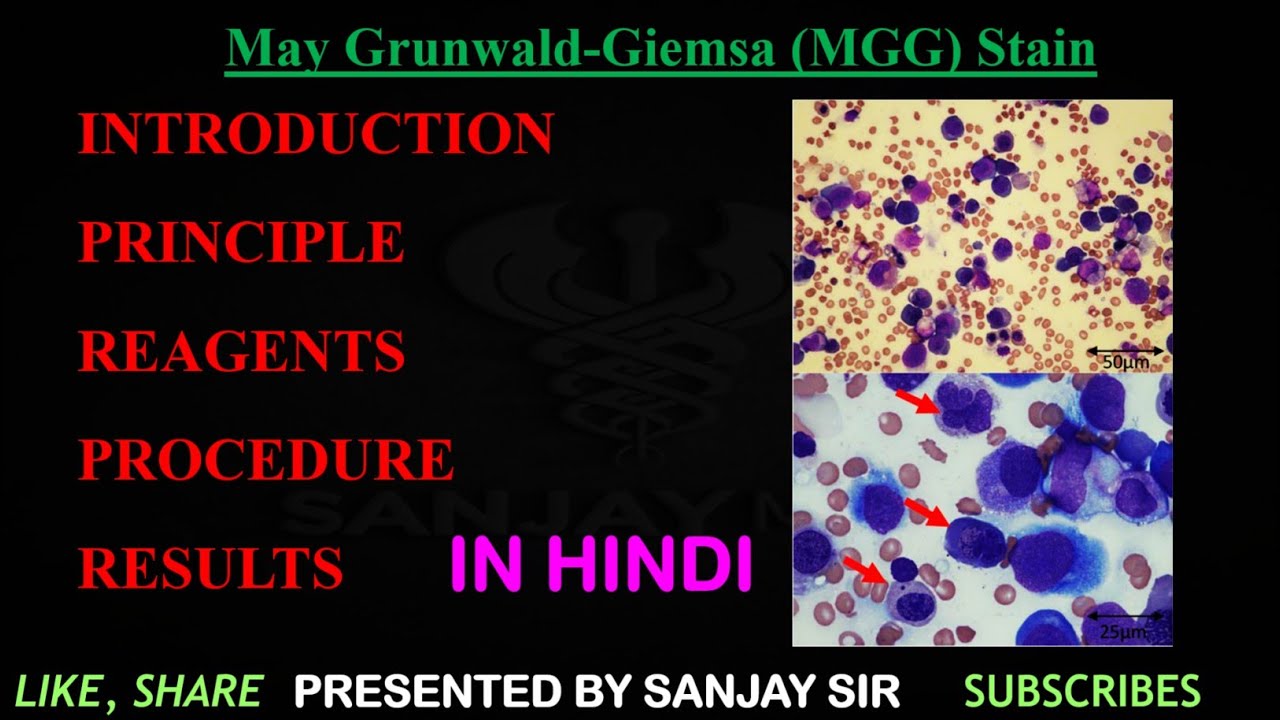 May Grunwald-Giemsa Stain in Hindi ll MMG stain ll principle ll procedure ll Results