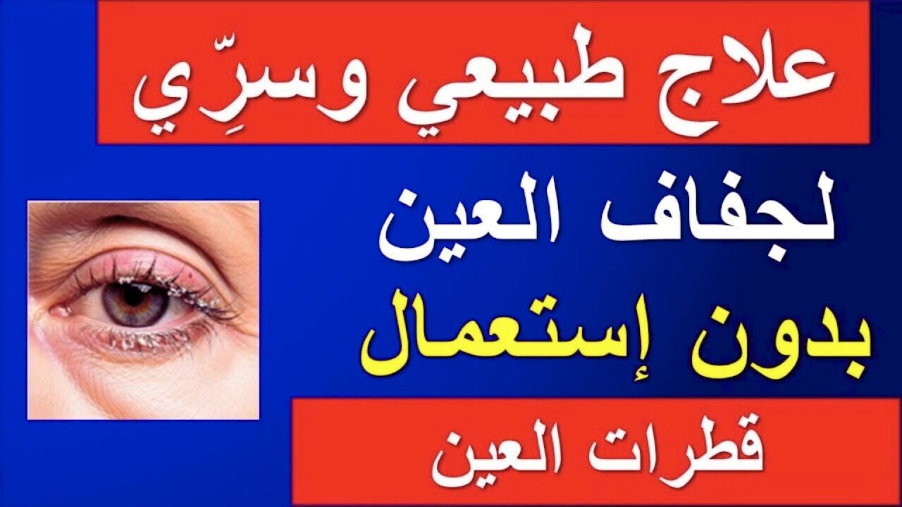 علاج جفاف العين طبيعيًا: 7 طرق بسيطة (بدون قطرات)