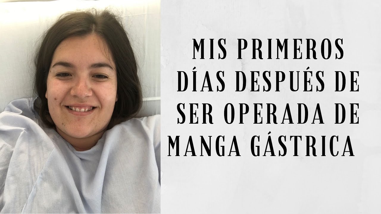 MANGA GÁSTRICA: Mis primeros días después de la operación