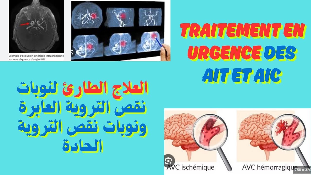 Traitement en urgence des AIT et AIC