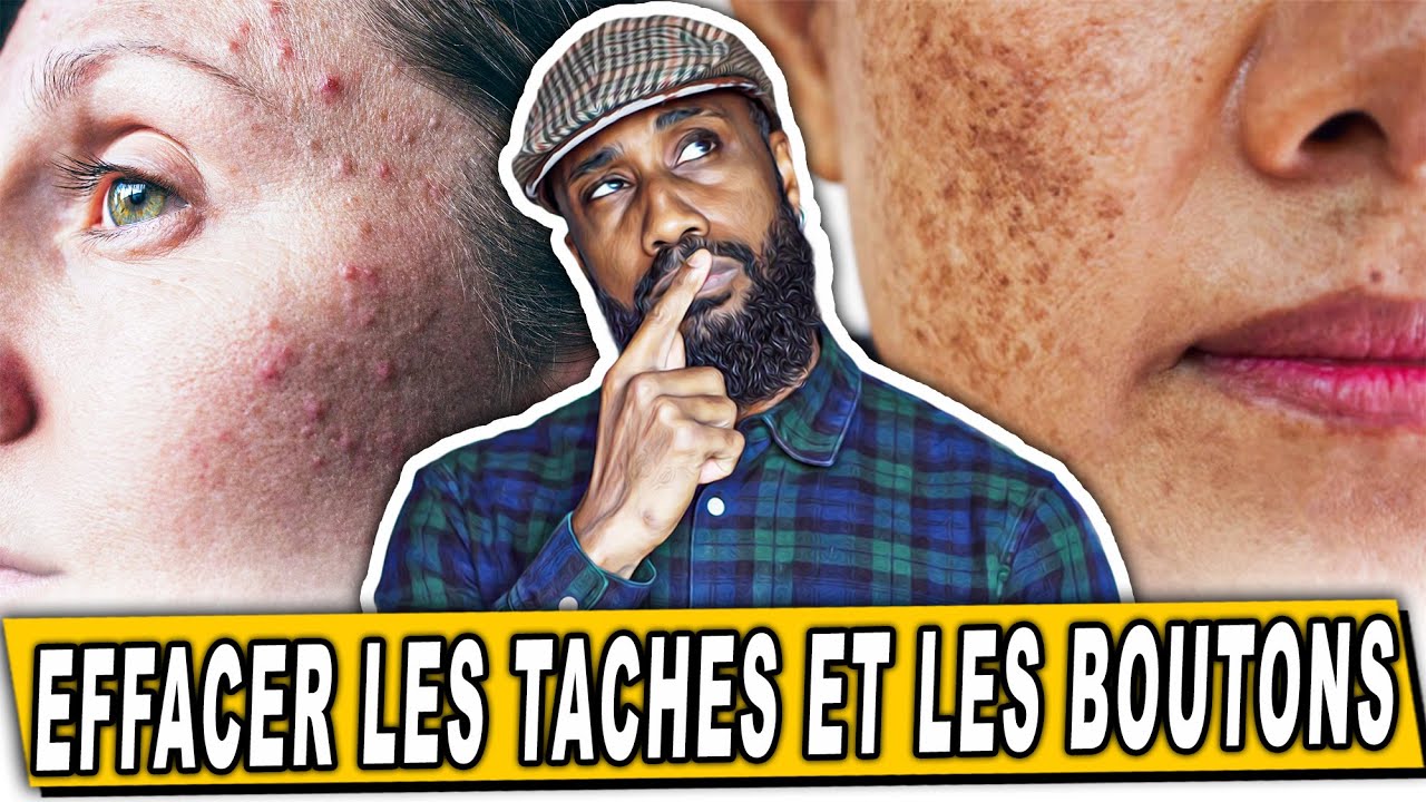 Comment résoudre les problemes de tâches brunes, rouges et de boutons