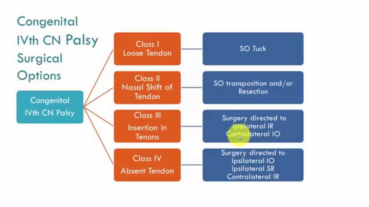 IVth CN Palsy Management