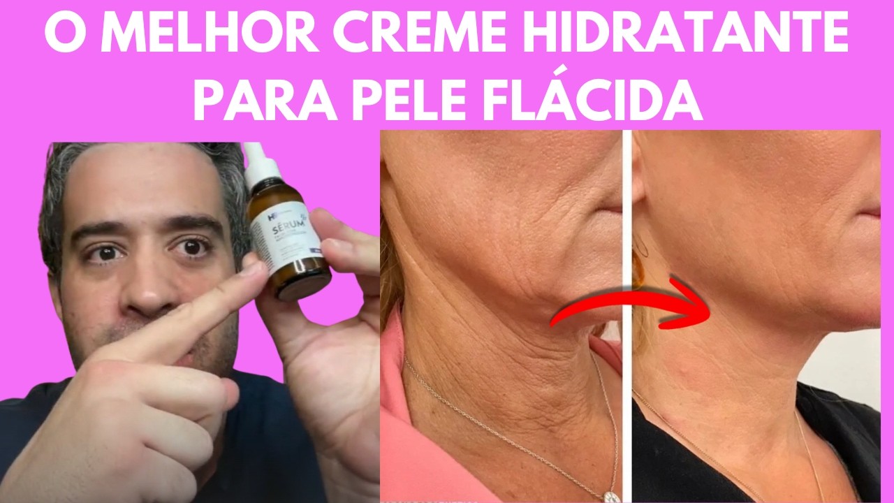 1 COLHER MELHOR COLÁGENO NATURAL PARA PELE LISINHA E SEM RUGAS EM 7 DIAS – URGENTE!