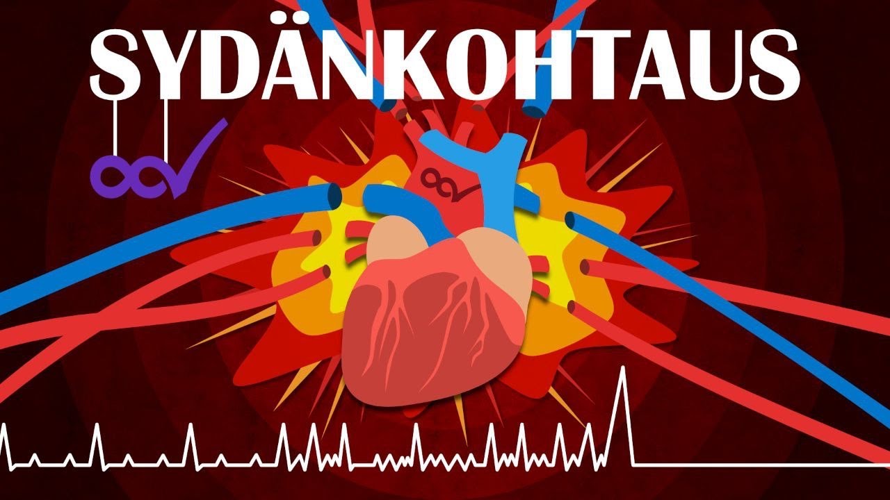 Mitä jos saat sy­dän­koh­tauksen?