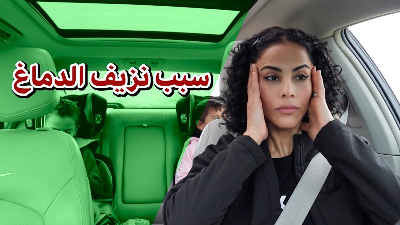 القصة كاملة  *سبب نزيف الدماغ*
