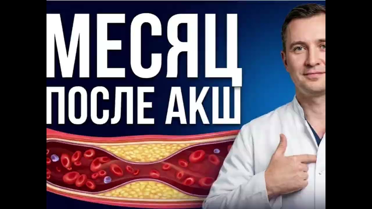 Месяц после АКШ: как я себя чувствую на самом деле