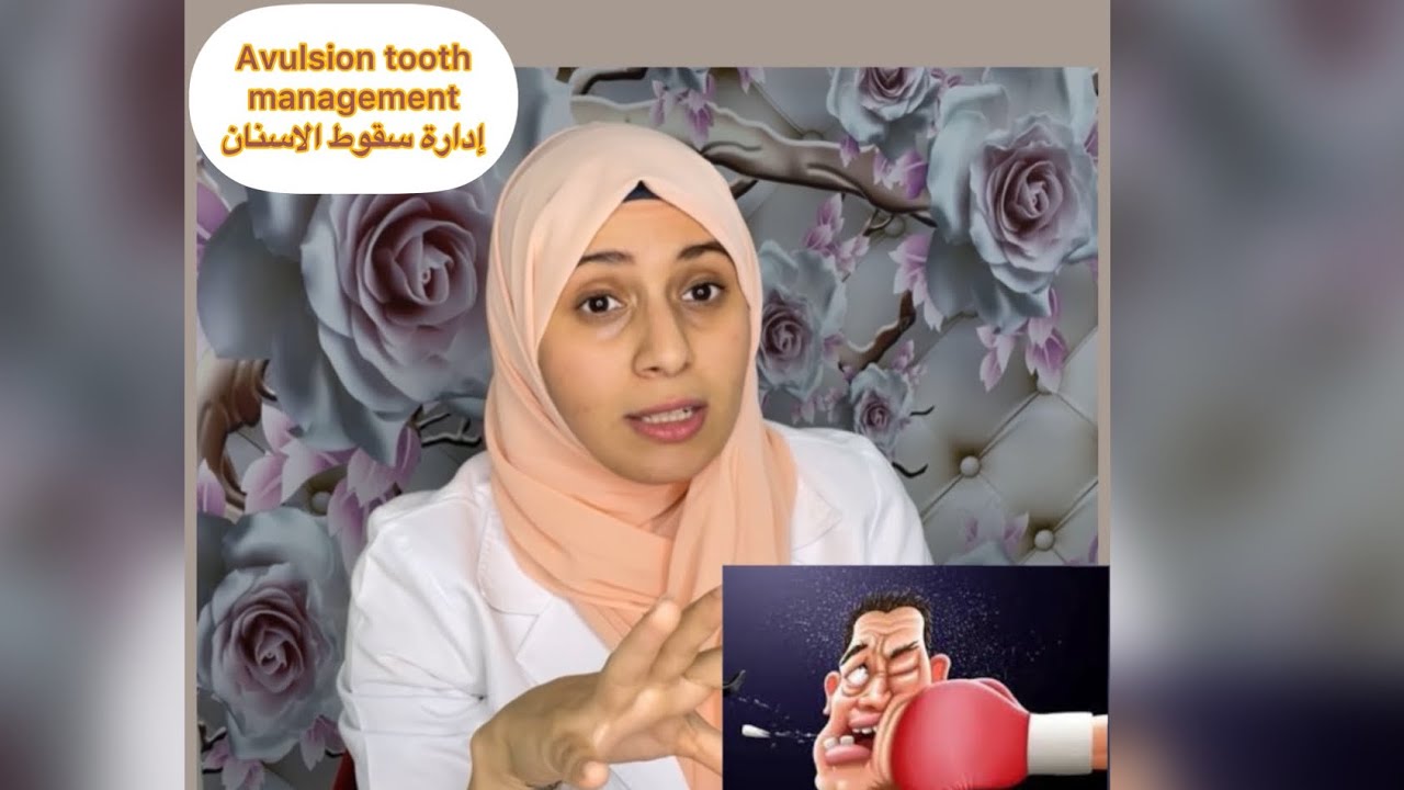 إدارة سقوط الاسنان .. 🦷Avulsion tooth management