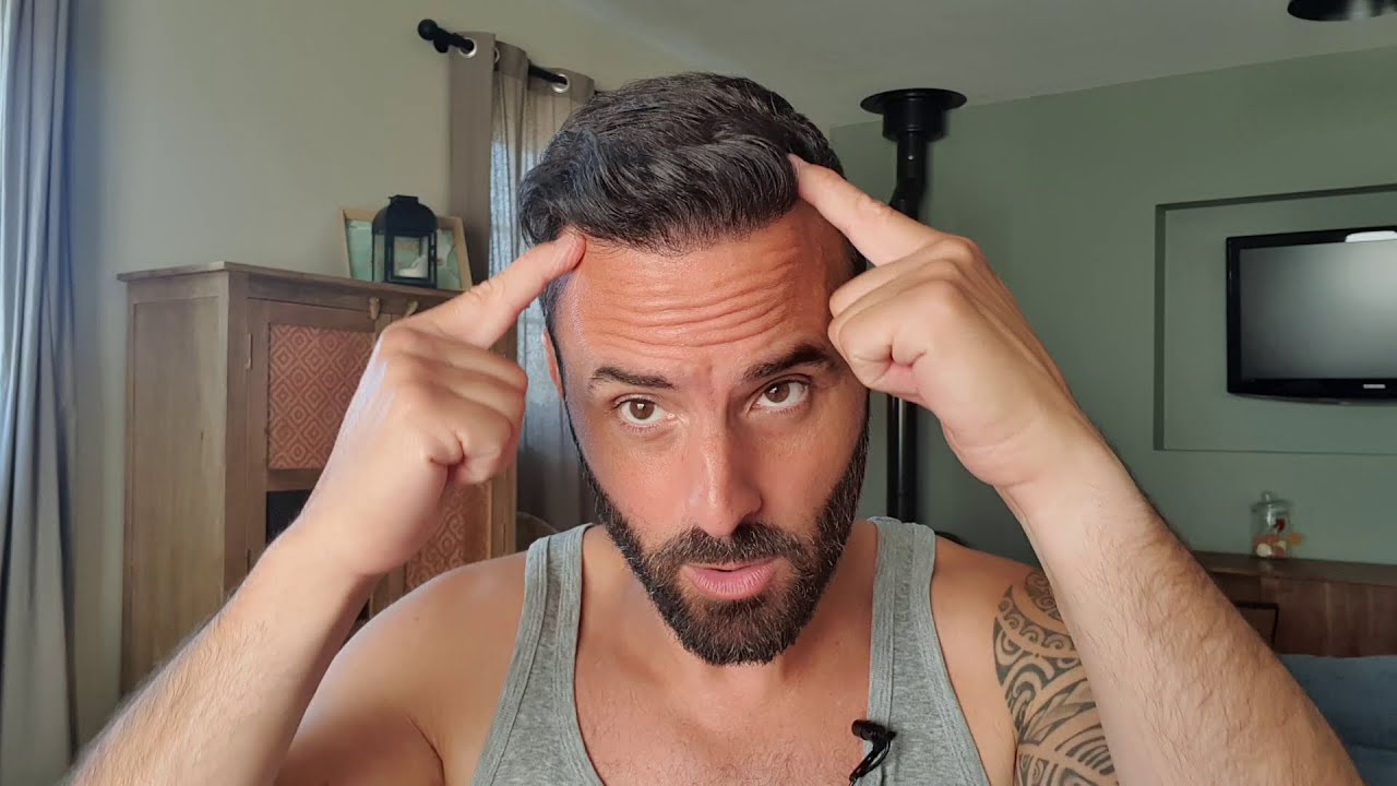 5 choses IMPORTANTES à savoir sur LA GREFFE DE CHEVEUX !