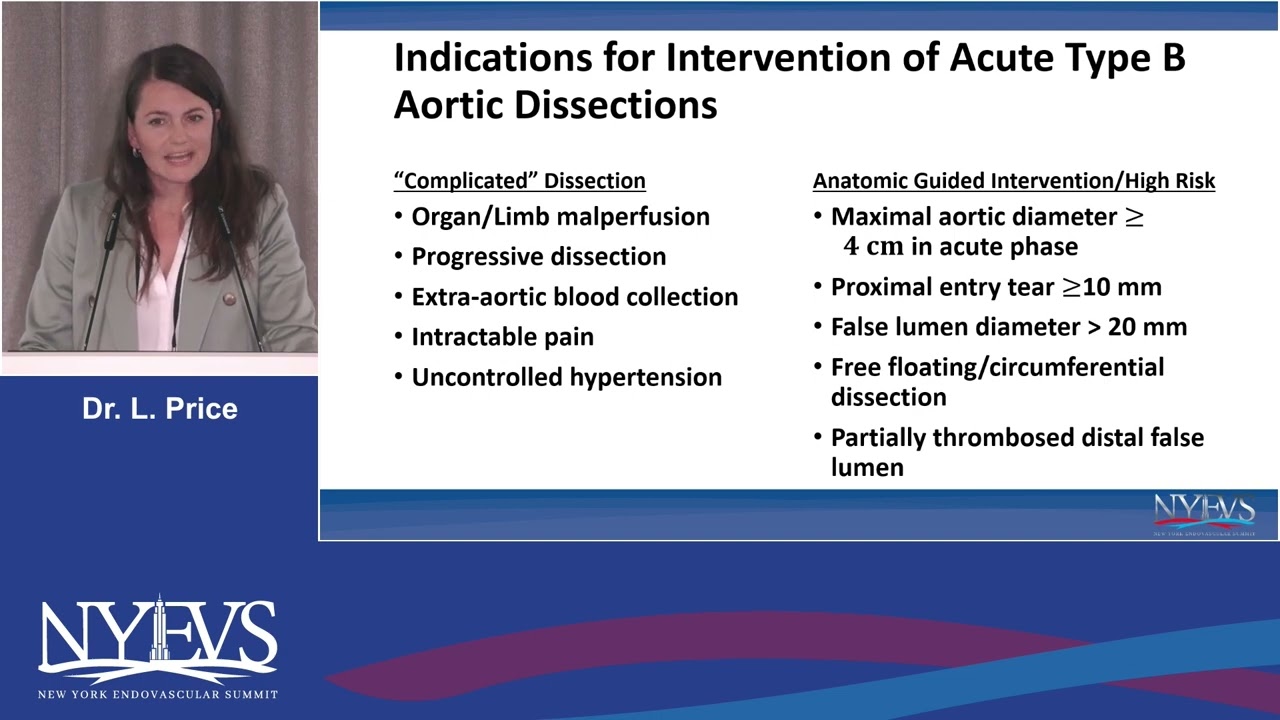 When and how to treat acute type B aortic dissection Lucyna Price Session II  Aortic Dissections