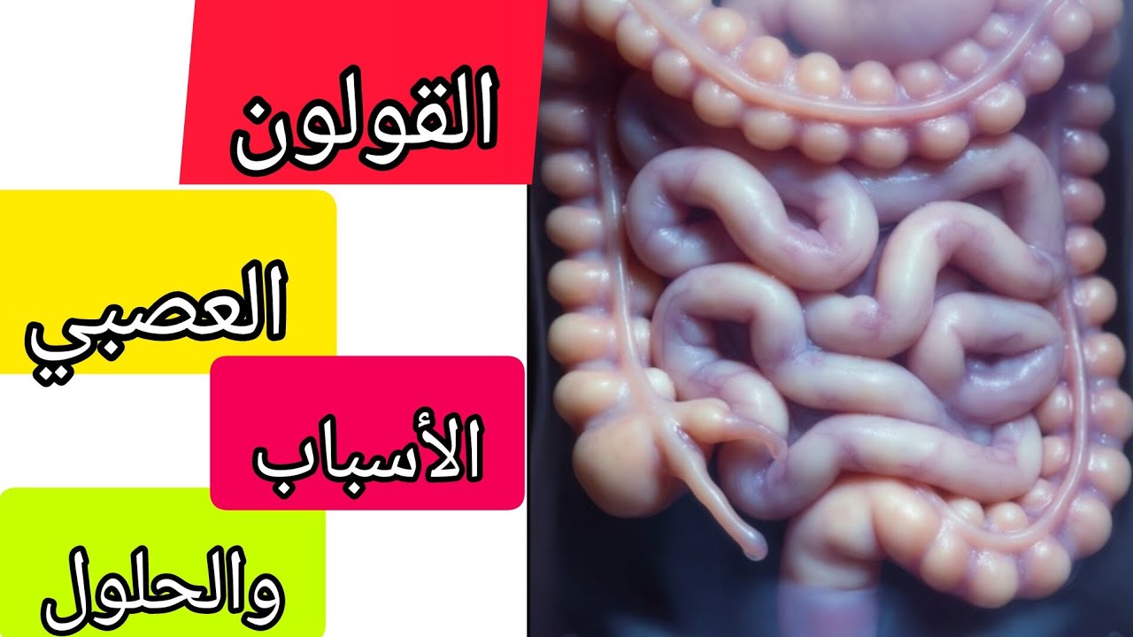  القولون العصبي  فرط حساسية الأمعاء. الأعراض  الأسباب  والحلول الطبيعية والطبية