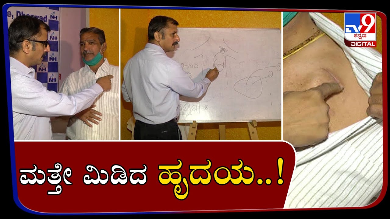 First Time A Rare Heart Operation Conducted Successfully In SDM Hubballi-Dharwad