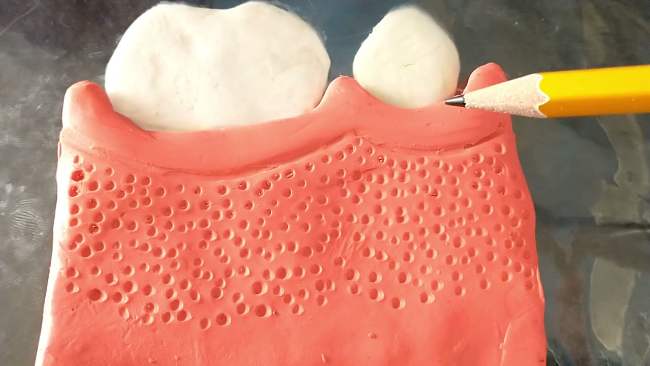 PERIODONCIA: TIPOS DE ENCÍAS