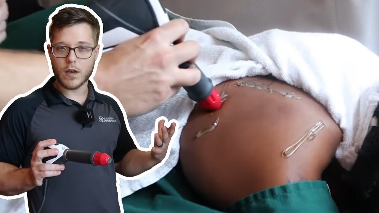 Shockwave Therapy Explained: Relieve Shoulder Pain with Mike's Expert Treatment (Part 1)