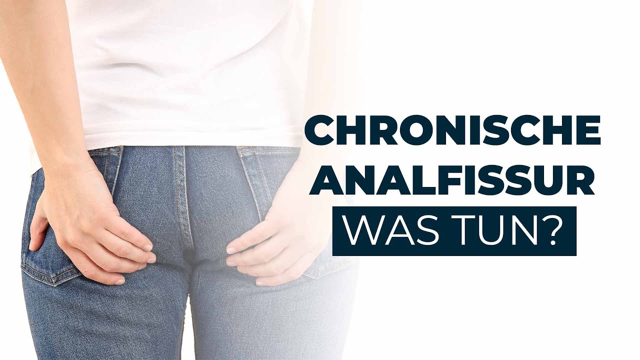 Was tun bei einer CHRONISCHEN Analfissur? Dr. Eduard Karsten klärt auf
