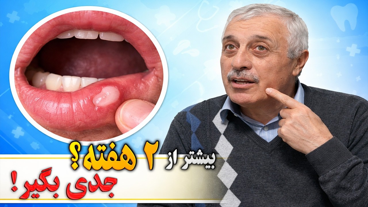 زخم دهان بیشتر از دو هفته طول کشید؟ این علامت خطر را جدی بگیرید