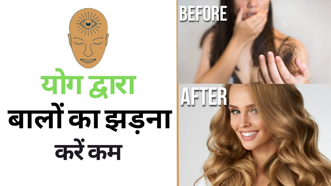ऐसे करें योग से बालों का झड़ना कम | Hair Fall Remedy at Home Fast