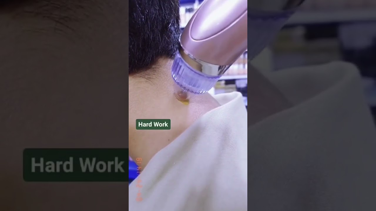 Vacuum Acne Pore Cleaner #youtubeshorts