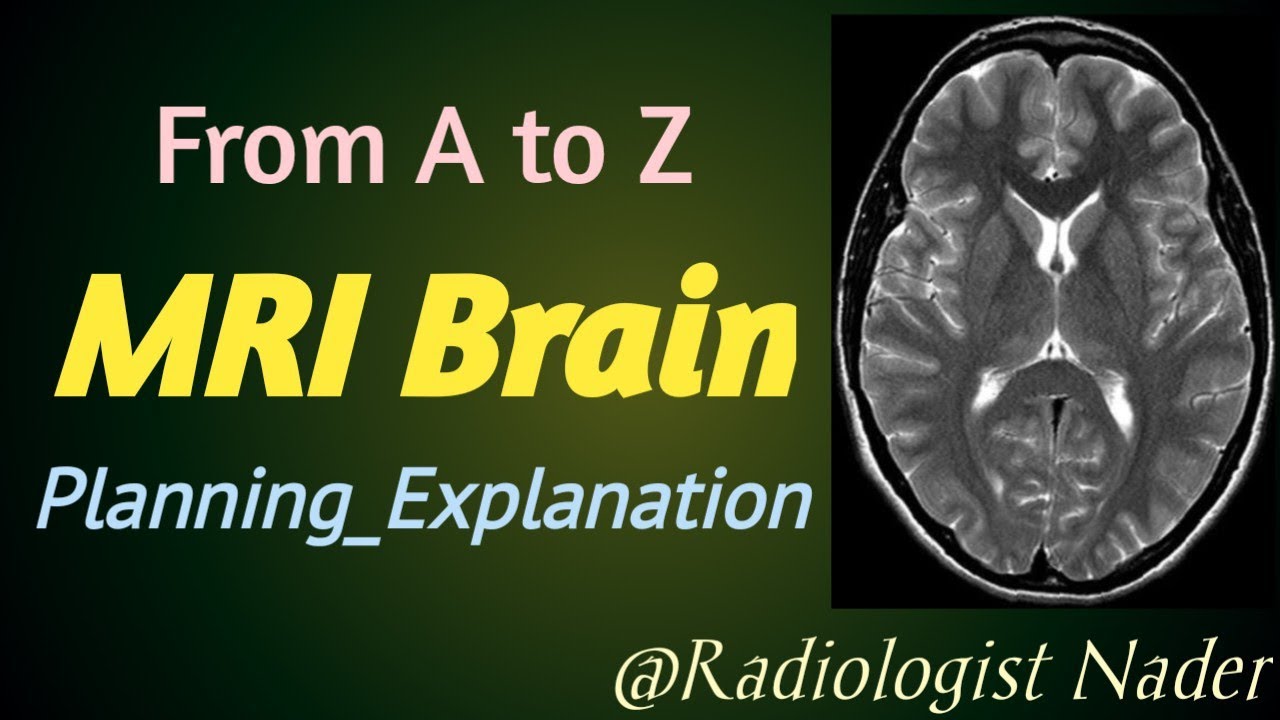 رنين مغناطيسي علي المخ بدون صبغة|MRI Brain without C