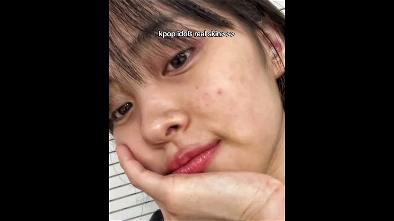 Kpop idols real skin 💪 #kpop #kpopidol #realskin #trendingshorts