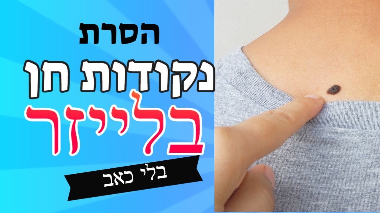 הסרת שומות ונקודות חן באמצעות לייזר