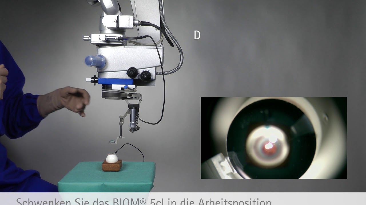 OCULUS BIOM&reg; 5cl, SDI&reg; 4c und BIOM&reg; Optic Set (Tutorial, Deutsch)
