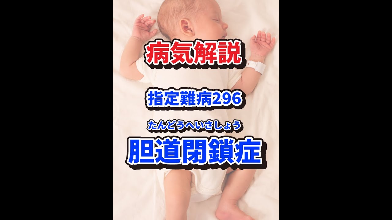 指定難病296 胆道閉鎖症とは？